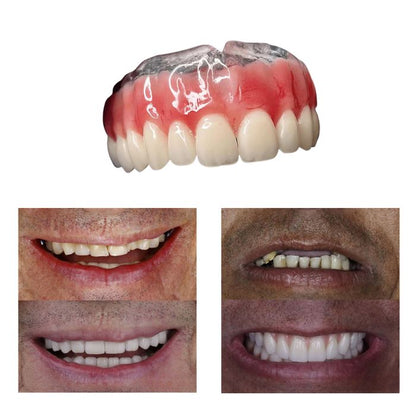 (2 POUR LE PRIX D’1) Dentier en silicone FIX | Ajustable et adaptatif + Kit de nettoyage OFFERT
